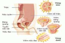 benh-viem-duong-tiet-nieu-va-nhung-qua