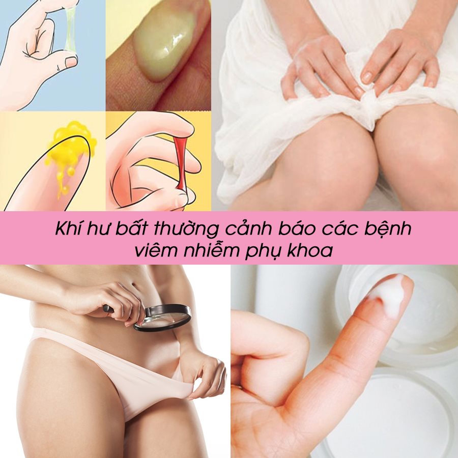 Bắt bệnh phụ khoa qua tính chất, màu sắc của khí hư