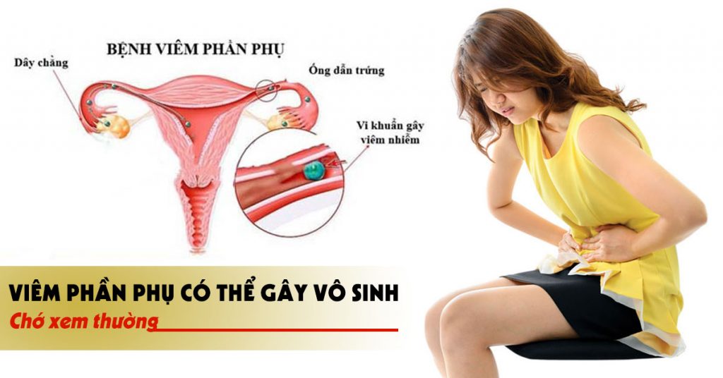 Viêm phần phụ là gì? có nguy hiểm không