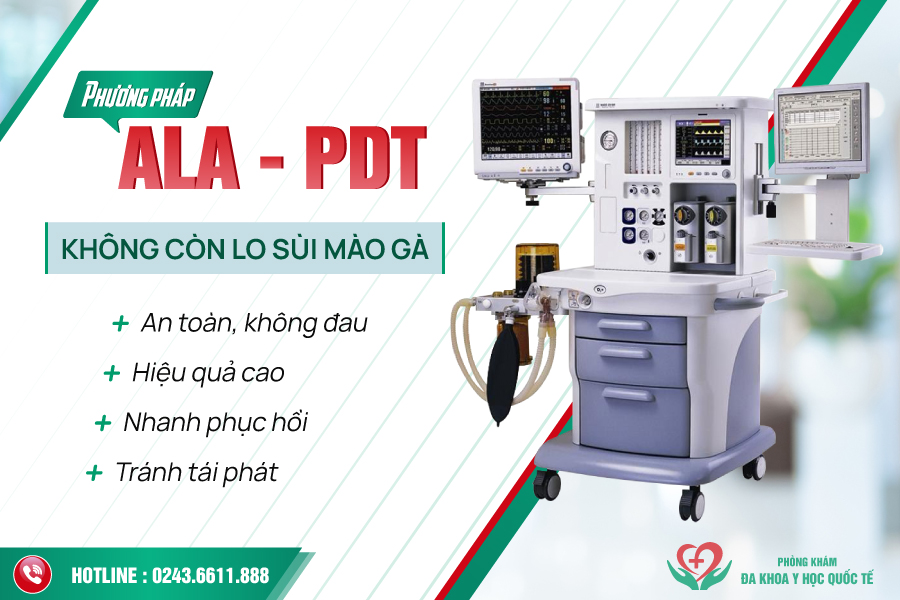 Điều trị sùi mào gà hiệu quả bằng phương pháp ALA – PDT thế hệ 2